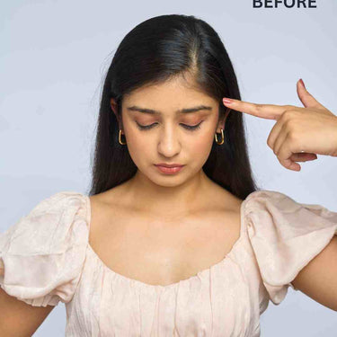 Front Hair Thinning Cover Up Patch