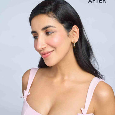 Front Hair Thinning Cover Up Patch