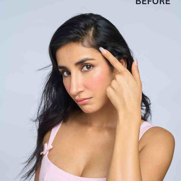Front Hair Thinning Cover Up Patch