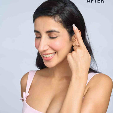 Front Hair Thinning Cover Up Patch